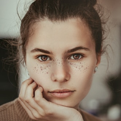 A person with brown hair pulled back looks directly at the camera, resting their chin on their hand like an aerial surveyor pondering the view from above. They have freckles across their cheeks and nose. The background is softly blurred.